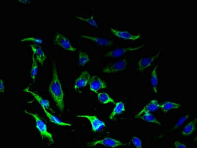 Polyclonal Rabbit anti-Human CRFR1 / CRHR1 Antibody (WB)