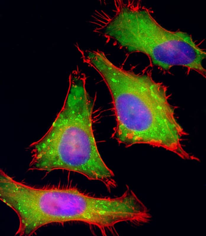 IHC-plus™ Polyclonal Rabbit anti-Human PGAP1 Antibody (N-Terminus, IHC, IF, WB)