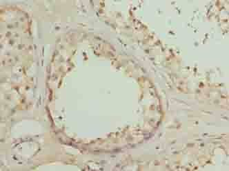 DSCR9 Antibody (aa1-149)