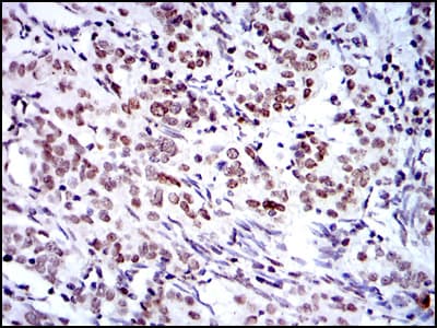 Monoclonal Mouse anti-Human BMI1 / PCGF4 Antibody (clone 3E3, IHC, IF, WB)