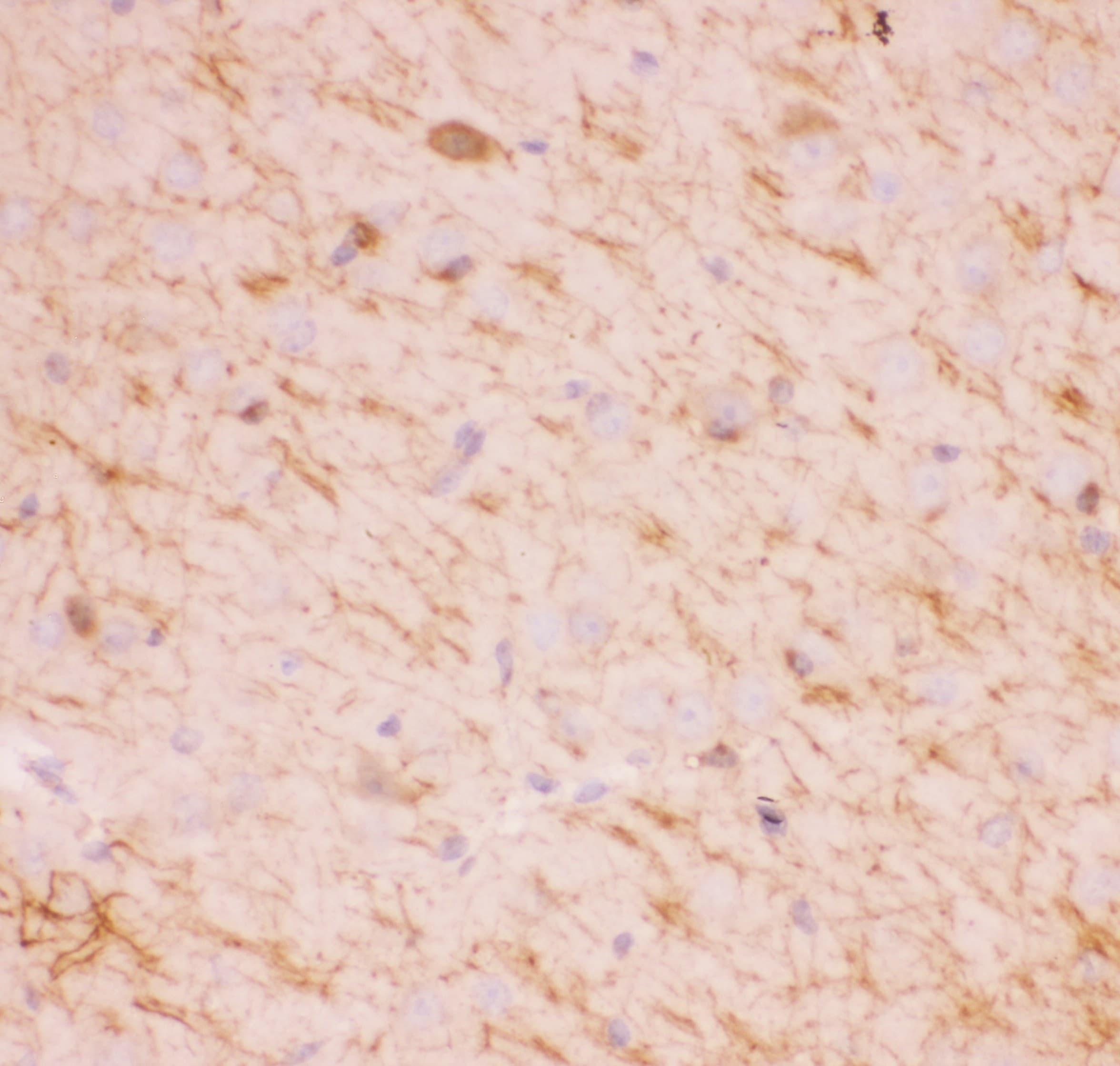SIRT2 / Sirtuin 2 Antibody (aa165-187)