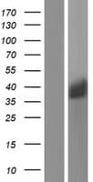 LGALS8 / Galectin 8 Protein (Over-Expression Lysate Myc-DDK (Flag))