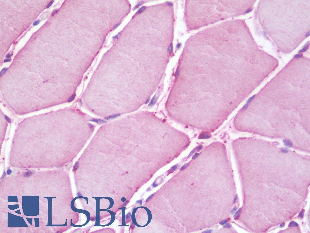 IHC-plus™ Polyclonal Rabbit anti-Human ACSL6 Antibody (aa499-548, IHC, WB)