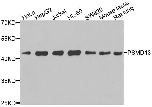 PSMD13 Antibody