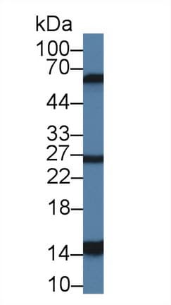 LGALS2 / Galectin 2 Antibody (aa1-123)