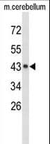 EXTL2 Antibody (aa269-295)