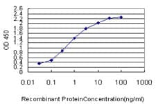 IHC-plus™ Monoclonal Mouse anti-Human IDH2 Antibody (clone 5F11, IHC, WB)