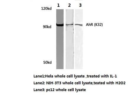 AHR Antibody (Lys32)