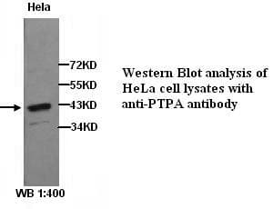 Polyclonal Rabbit anti-Human PPP2R4 Antibody (WB)