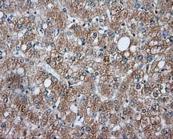 LIPG / Endothelial Lipase Antibody (clone OTI5C3)