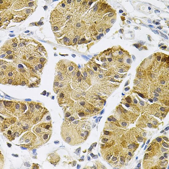 NTRK1 / TrkA Antibody