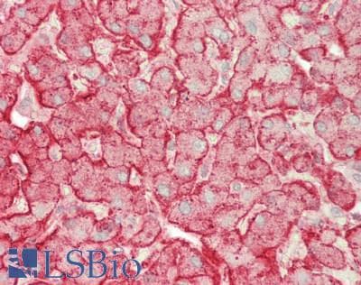 IHC-plus™ ASGR1 / ASGPR Antibody