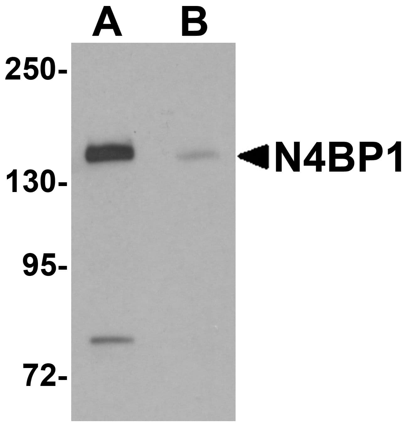 N4BP1 Antibody