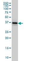 TWF1 / PTK9 Antibody (clone 1E2)