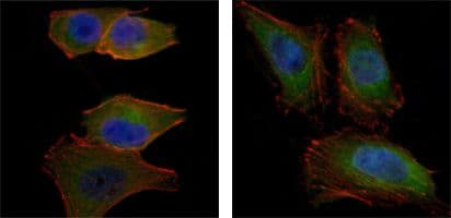 AKT2 Antibody (clone 1B6)