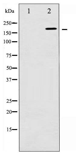WNK1 Antibody (phospho-Thr58)