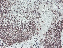 APMAP / C20orf3 Antibody (clone OTI1A9)