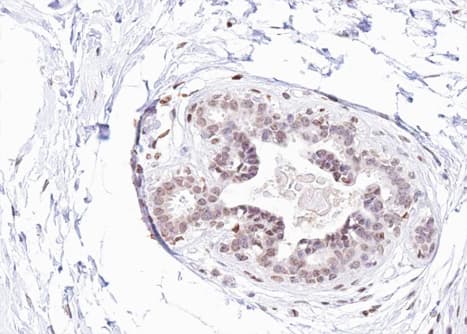 ER Alpha / Estrogen Receptor Antibody (phospho-Tyr537)