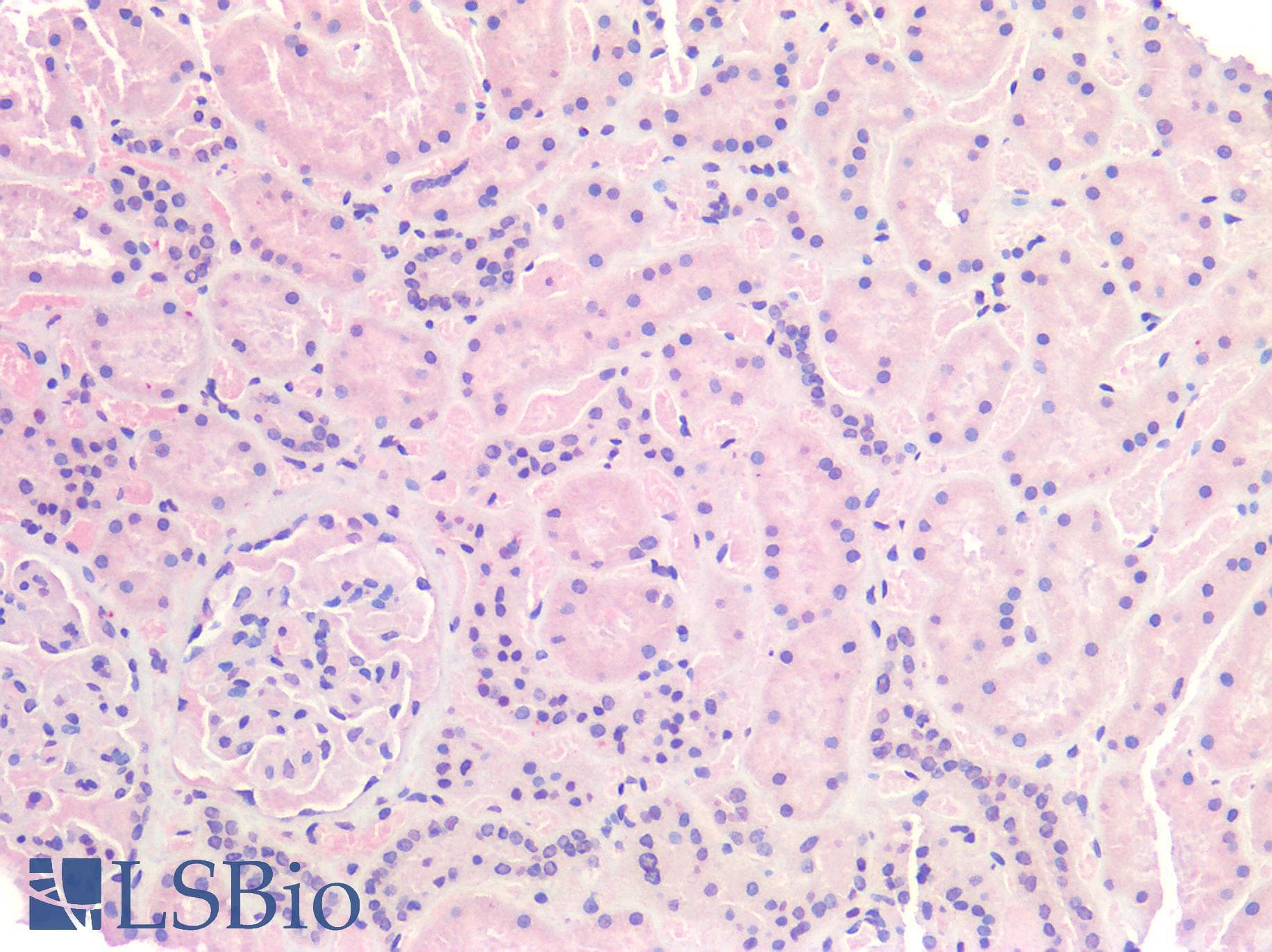 IHC-plus™ IGF1R / IGF1 Receptor Antibody