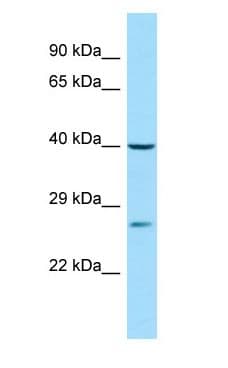 DJ858B16.2 / PISD Antibody (aa277-326)