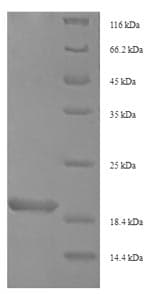 Oxyopes takobius Oxyopinin-4a (Oxyopinin-4a) Protein (Recombinant 6His-SUMO, N-terminus)