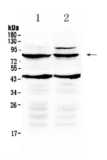 TSH Receptor / TSHR Antibody