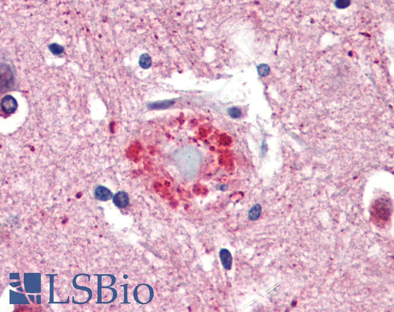 IHC-plus™ Ubiquitin Antibody