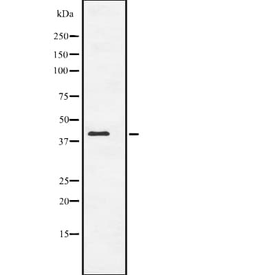 Polyclonal Rabbit anti-Human ACTC1 / Alpha Cardiac Actin Antibody (WB)