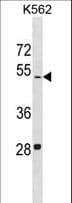 LDHAL6B Antibody (aa45-71)