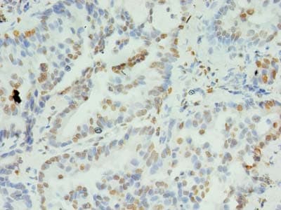 XRCC5 / Ku80 Antibody