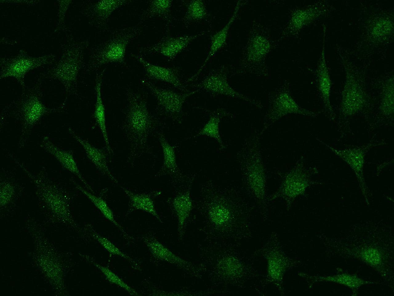 NUDT5 Antibody