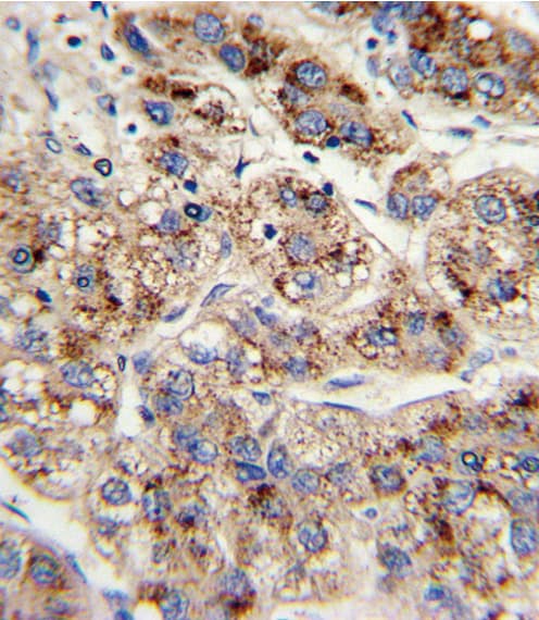 IHC-plus™ EHHADH / Enoyl-Coa Hydratase Antibody (aa662-690)