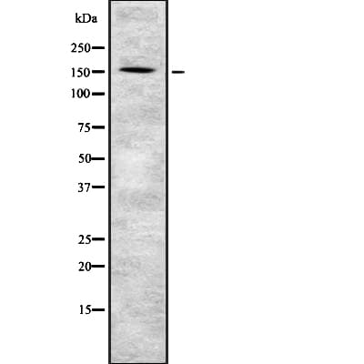 Polyclonal Rabbit anti-Human PIK3R4 Antibody (WB)