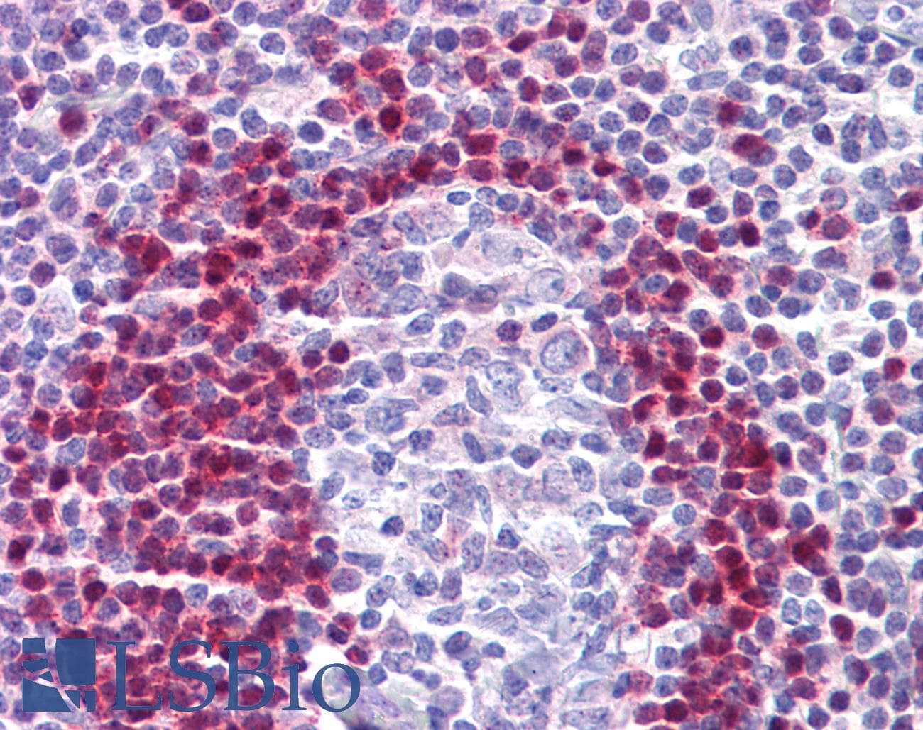 IHC-plus™ ADK / Adenosine Kinase Antibody (clone AT4F8)