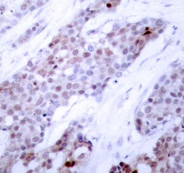 ATF4 Antibody (phospho-Ser245)