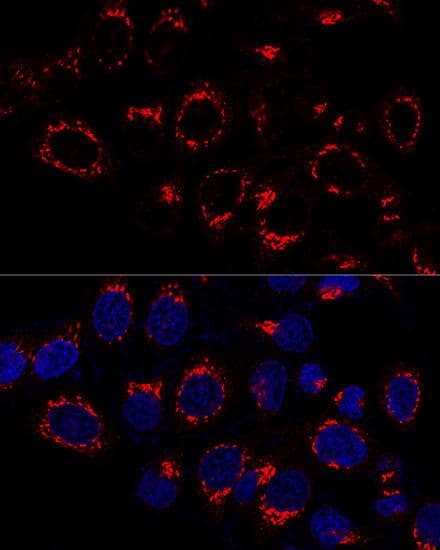 Polyclonal Rabbit anti-Human US01 / p115 Antibody (IF, WB)