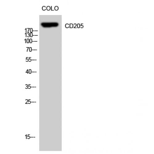 DEC-205 / CD205 / LY75 Antibody (Internal)