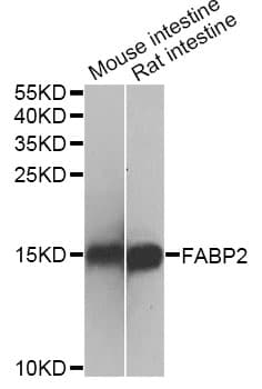 IHC-plus™ Polyclonal Rabbit anti-Human I-FABP / FABP2 Antibody (IHC, IF, WB)