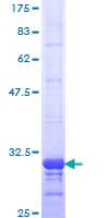Human CCR2 Protein (Recombinant GST, N-terminus)