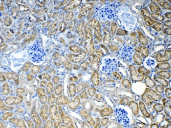 Polyclonal Rabbit anti-Human ABCC2 / MRP2 Antibody (IHC, WB)