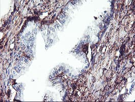 SCHIP1 Antibody (clone OTI1C8)