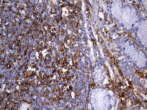 PDPN / Podoplanin Antibody (aa23-131, clone OTI7B4, Carrier-free)