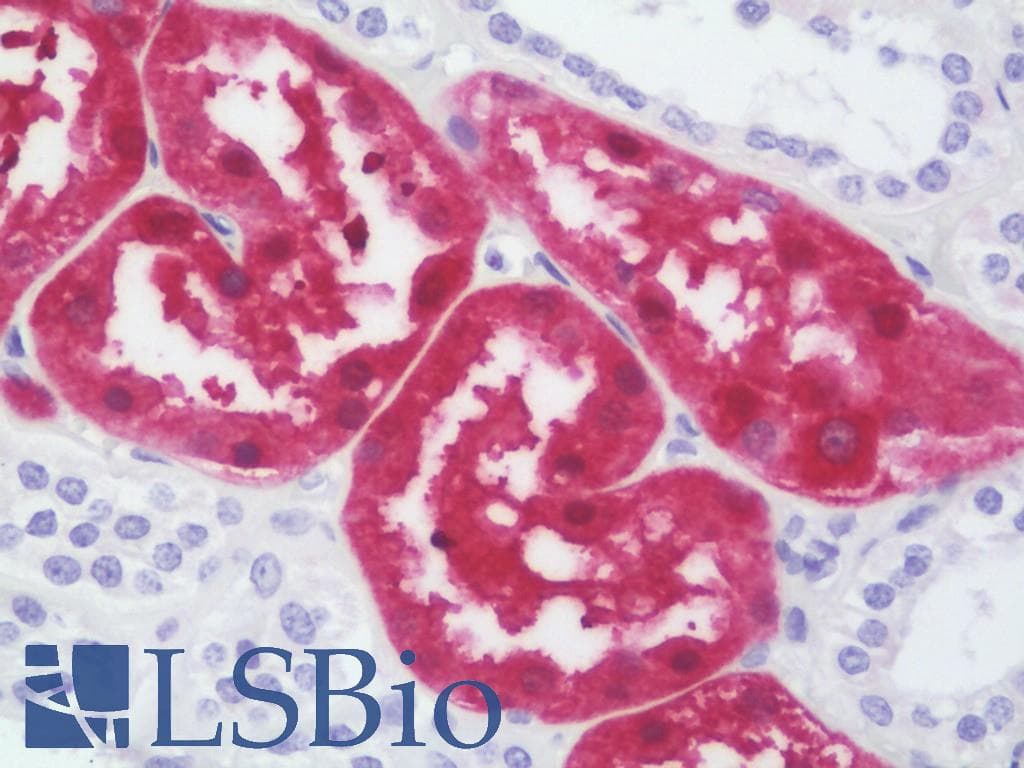 IHC-plus™ Monoclonal Mouse anti-Human ASS1 / ASS Antibody (clone 2C10, IHC, WB)
