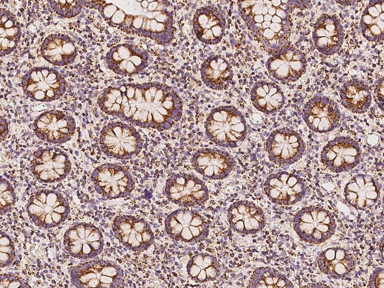 NCOA3 / SRC-3 / AIB1 Antibody