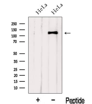 Polyclonal Rabbit anti-Human IWS1 Antibody (WB)