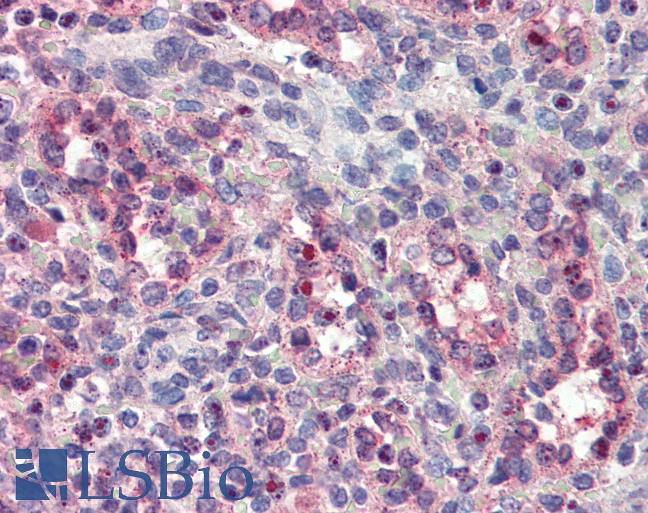 IHC-plus™ Monoclonal Mouse anti-Human FER Antibody (clone 5D2C4, IHC, IF, WB)