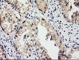 Monoclonal Mouse anti-Human EIF4E2 / IF4e Antibody (clone OTI1C1, IHC, WB)