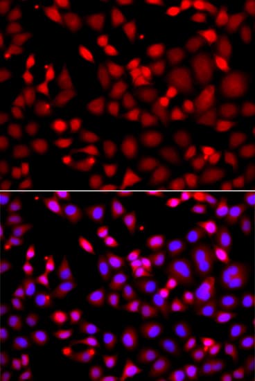 MTUS1 Antibody