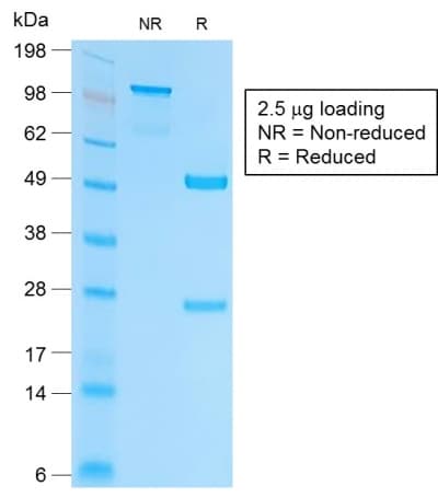 IHC-plus™ Recombinant Monoclonal Rabbit anti-Human EPCAM Antibody (clone EGP40/2041R, aa100-224, IHC, WB)