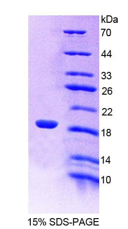 Rat LDOC1 Protein (Recombinant His-T7)